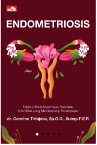 Image of Endometriosis